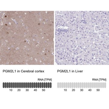 Anti-PGM2L1 antibody produced in rabbit Prestige Antibodies&#174; Powered by Atlas Antibodies, affinity isolated antibody, buffered aqueous glycerol solution