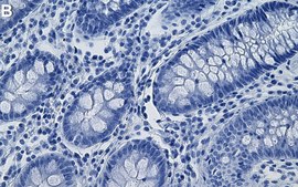 Anti-CD138/Syndecan-1 Antibody, clone 3N22-1 ZooMAb&#174; Rabbit Monoclonal recombinant, expressed in HEK 293 cells