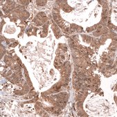 Monoclonal Anti-Lgr5 Antibody Produced In Mouse Prestige Antibodies&#174; Powered by Atlas Antibodies, clone CL13579, affinity isolated antibody, buffered aqueous glycerol solution