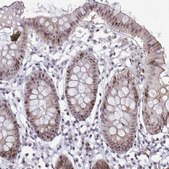 Anti-RBL1 antibody produced in rabbit Prestige Antibodies&#174; Powered by Atlas Antibodies, affinity isolated antibody, buffered aqueous glycerol solution