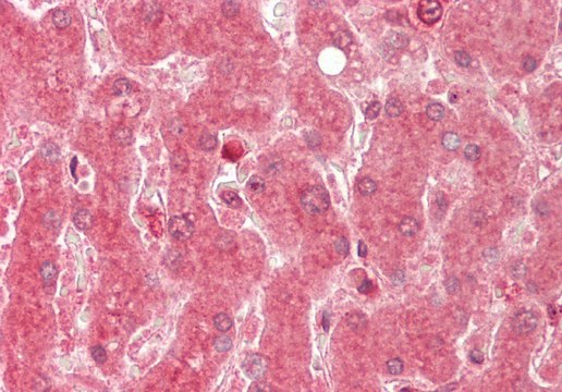 Anti-ALAS1 antibody produced in rabbit affinity isolated antibody