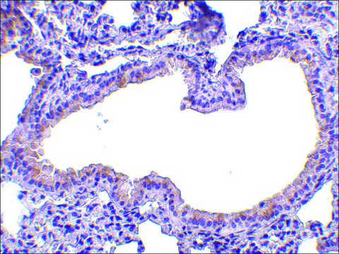 Anti-SLPI (ab2) antibody produced in rabbit affinity isolated antibody, buffered aqueous solution