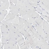 Anti-CASP6 antibody produced in rabbit Prestige Antibodies&#174; Powered by Atlas Antibodies, affinity isolated antibody, buffered aqueous glycerol solution