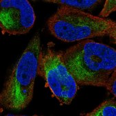Anti-ZKSCAN5 antibody produced in rabbit Prestige Antibodies&#174; Powered by Atlas Antibodies, affinity isolated antibody, buffered aqueous glycerol solution