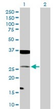 Anti-TAGLN antibody produced in rabbit purified immunoglobulin, buffered aqueous solution