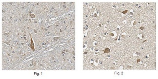 Anti-Choline Transporter Antibody from rabbit, purified by affinity chromatography