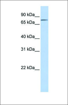 Anti-ITGB8 antibody produced in rabbit affinity isolated antibody