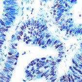 Anti-USP7/HAUSP antibody produced in rabbit
