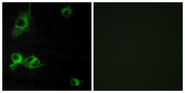 Anti-LAMA1 antibody produced in rabbit affinity isolated antibody