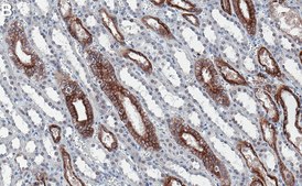 Anti-WWP2 Antibody, clone 1C18 ZooMAb&#174; Rabbit Monoclonal recombinant, expressed in HEK 293 cells