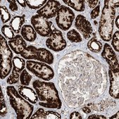 Anti-NDUFAF3 antibody produced in rabbit Prestige Antibodies&#174; Powered by Atlas Antibodies, affinity isolated antibody, buffered aqueous glycerol solution