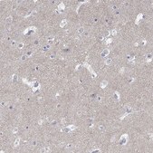 Anti-GRIA3 antibody produced in rabbit Prestige Antibodies&#174; Powered by Atlas Antibodies, affinity isolated antibody, buffered aqueous glycerol solution