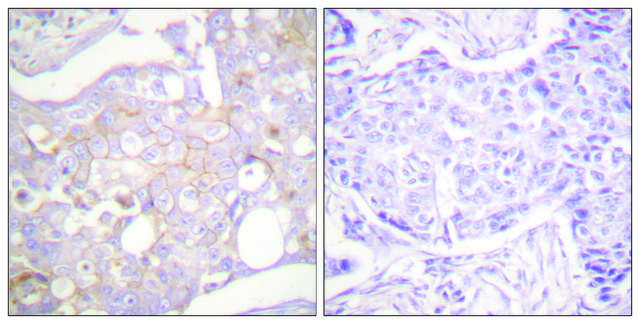 Anti-Claudin 4 antibody produced in rabbit affinity isolated antibody