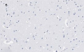 Anti-Calretinin Antibody, clone 3K22, ZooMAb&#174; Rabbit Monoclonal recombinant, expressed in HEK 293 cells