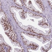 Anti-GSTO2 antibody produced in rabbit Prestige Antibodies&#174; Powered by Atlas Antibodies, affinity isolated antibody, buffered aqueous glycerol solution