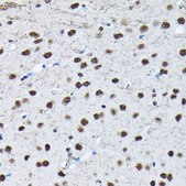 Anti-Phospho-c-Jun-S63 antibody produced in rabbit