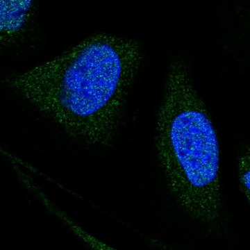 Anti-WDR7 antibody produced in rabbit Prestige Antibodies&#174; Powered by Atlas Antibodies, affinity isolated antibody, buffered aqueous glycerol solution