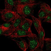 Anti-UBD antibody produced in rabbit Prestige Antibodies&#174; Powered by Atlas Antibodies, affinity isolated antibody, buffered aqueous glycerol solution