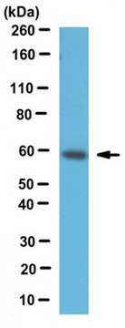 Anti-PKM2 Antibody serum, from rabbit