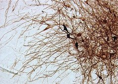 Anti-Tyrosine Hydroxylase Antibody, clone 2/40/15 clone 2/40/15, Chemicon&#174;, from mouse