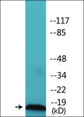 Anti-phospho-Survivin (pThr34) antibody produced in rabbit affinity isolated antibody