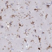 Anti-AIF1 antibody produced in rabbit Prestige Antibodies&#174; Powered by Atlas Antibodies, affinity isolated antibody, buffered aqueous glycerol solution