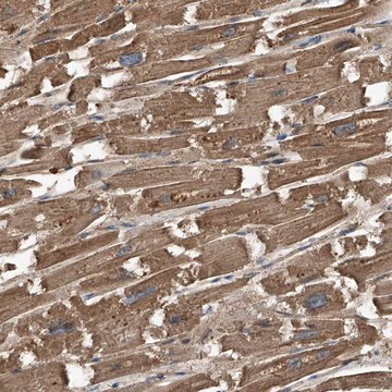 Anti-KCNJ2 antibody produced in rabbit Prestige Antibodies&#174; Powered by Atlas Antibodies, affinity isolated antibody, buffered aqueous glycerol solution