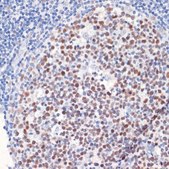 Anti-DNMT1 antibody produced in rabbit