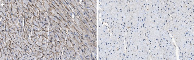 Anti-&#945;-Dystroglycan Antibody