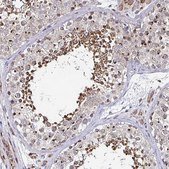 Anti-ATG3 antibody produced in rabbit Prestige Antibodies&#174; Powered by Atlas Antibodies, affinity isolated antibody, buffered aqueous glycerol solution