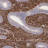 Anti-LGALS1 antibody produced in rabbit Prestige Antibodies&#174; Powered by Atlas Antibodies, affinity isolated antibody, buffered aqueous glycerol solution