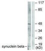 Anti-Synuclein &#946; antibody produced in rabbit affinity isolated antibody