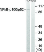 Anti-NF-&#954;B p100 antibody produced in rabbit affinity isolated antibody