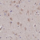 Anti-PTHLH antibody produced in rabbit Prestige Antibodies&#174; Powered by Atlas Antibodies, affinity isolated antibody, buffered aqueous glycerol solution