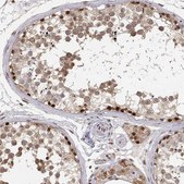Anti-BRCA1 Prestige Antibodies&#174; Powered by Atlas Antibodies, affinity isolated antibody