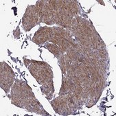 Anti-SYNPO2 antibody produced in rabbit Prestige Antibodies&#174; Powered by Atlas Antibodies, affinity isolated antibody
