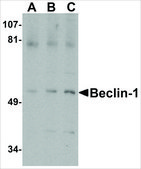 Anti-Beclin-1 (ab1) antibody produced in rabbit affinity isolated antibody, buffered aqueous solution