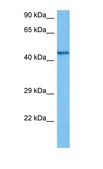 Anti-CHRNB2 antibody produced in rabbit affinity isolated antibody