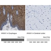 Anti-ANXA1 antibody produced in rabbit Prestige Antibodies&#174; Powered by Atlas Antibodies, affinity isolated antibody, buffered aqueous glycerol solution