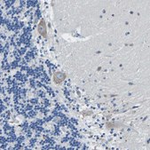 Anti-MC4R antibody produced in rabbit Prestige Antibodies&#174; Powered by Atlas Antibodies, affinity isolated antibody, buffered aqueous glycerol solution