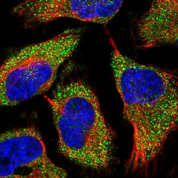 Anti-TREX1 antibody produced in rabbit Prestige Antibodies&#174; Powered by Atlas Antibodies, affinity isolated antibody