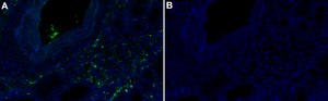 Anti-MCP-1 Antibody, clone 2G17 ZooMAb&#174; Rabbit Monoclonal recombinant, expressed in HEK 293 cells