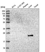 Anti-GGT2 antibody produced in rabbit Prestige Antibodies&#174; Powered by Atlas Antibodies, affinity isolated antibody, buffered aqueous glycerol solution