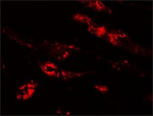 Anti-PEAR1 antibody produced in rabbit affinity isolated antibody, buffered aqueous solution