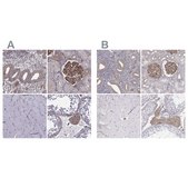 Anti-MYH9 antibody produced in rabbit Prestige Antibodies&#174; Powered by Atlas Antibodies, affinity isolated antibody, buffered aqueous glycerol solution
