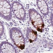 Monoclonal Anti-CHGA antibody produced in mouse Prestige Antibodies&#174; Powered by Atlas Antibodies, clone CL0166, purified immunoglobulin, buffered aqueous glycerol solution