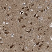 Anti-TOMM70 antibody produced in rabbit Prestige Antibodies&#174; Powered by Atlas Antibodies, affinity isolated antibody, buffered aqueous glycerol solution