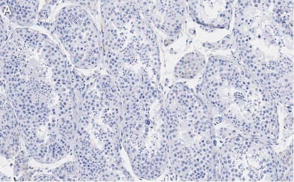 Anti-Ac-&#945;-Tubulin (Lys40) Antibody, clone 1L10, ZooMAb&#174; Rabbit Monoclonal recombinant, expressed in HEK 293 cells