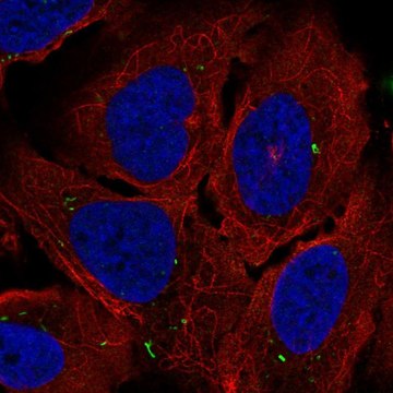 Anti-ADCY7 antibody produced in rabbit Prestige Antibodies&#174; Powered by Atlas Antibodies, affinity isolated antibody