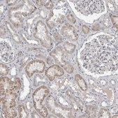 Anti-STC1 antibody produced in rabbit Prestige Antibodies&#174; Powered by Atlas Antibodies, affinity isolated antibody, buffered aqueous glycerol solution